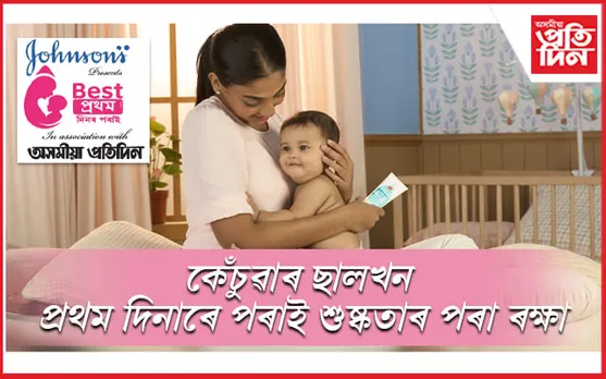 কেঁচুৱাৰ ছালখন প্ৰথম দিনাৰে পৰাই শুষ্কতাৰ পৰা ৰক্ষা